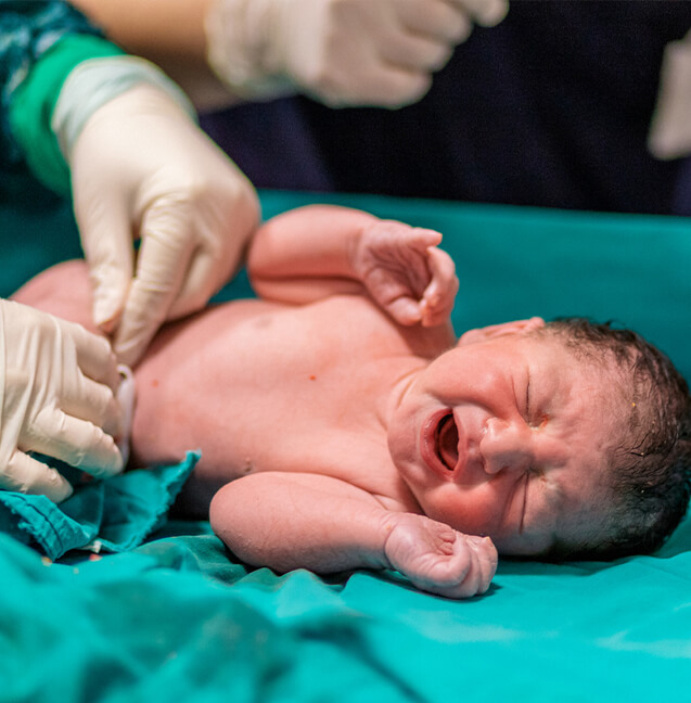 newborn baby after c-section